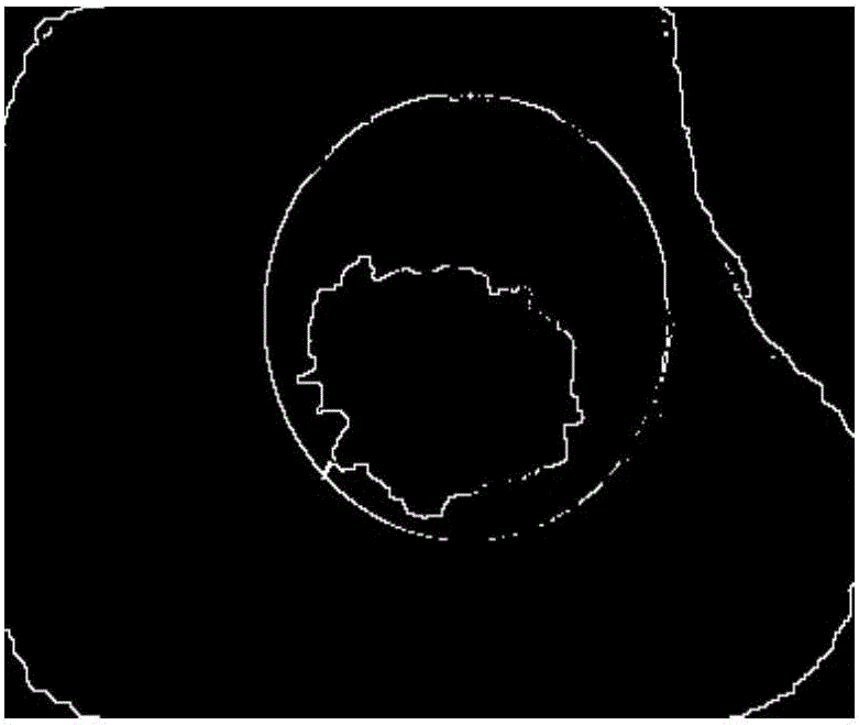 An edge detection method for oil well casing damage images based on grey relational analysis and zernike moment