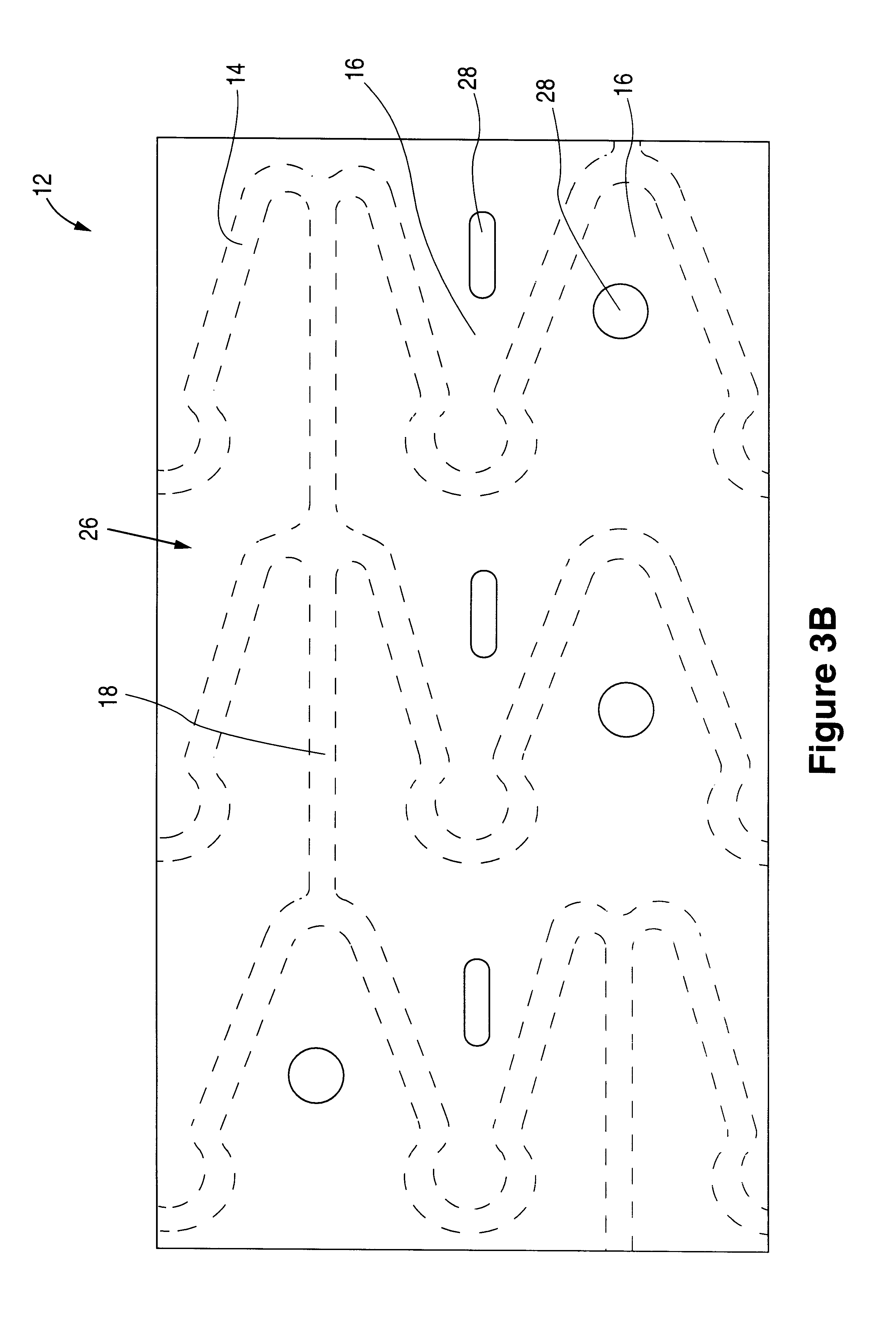 Sheath for a prosthesis and methods of forming the same