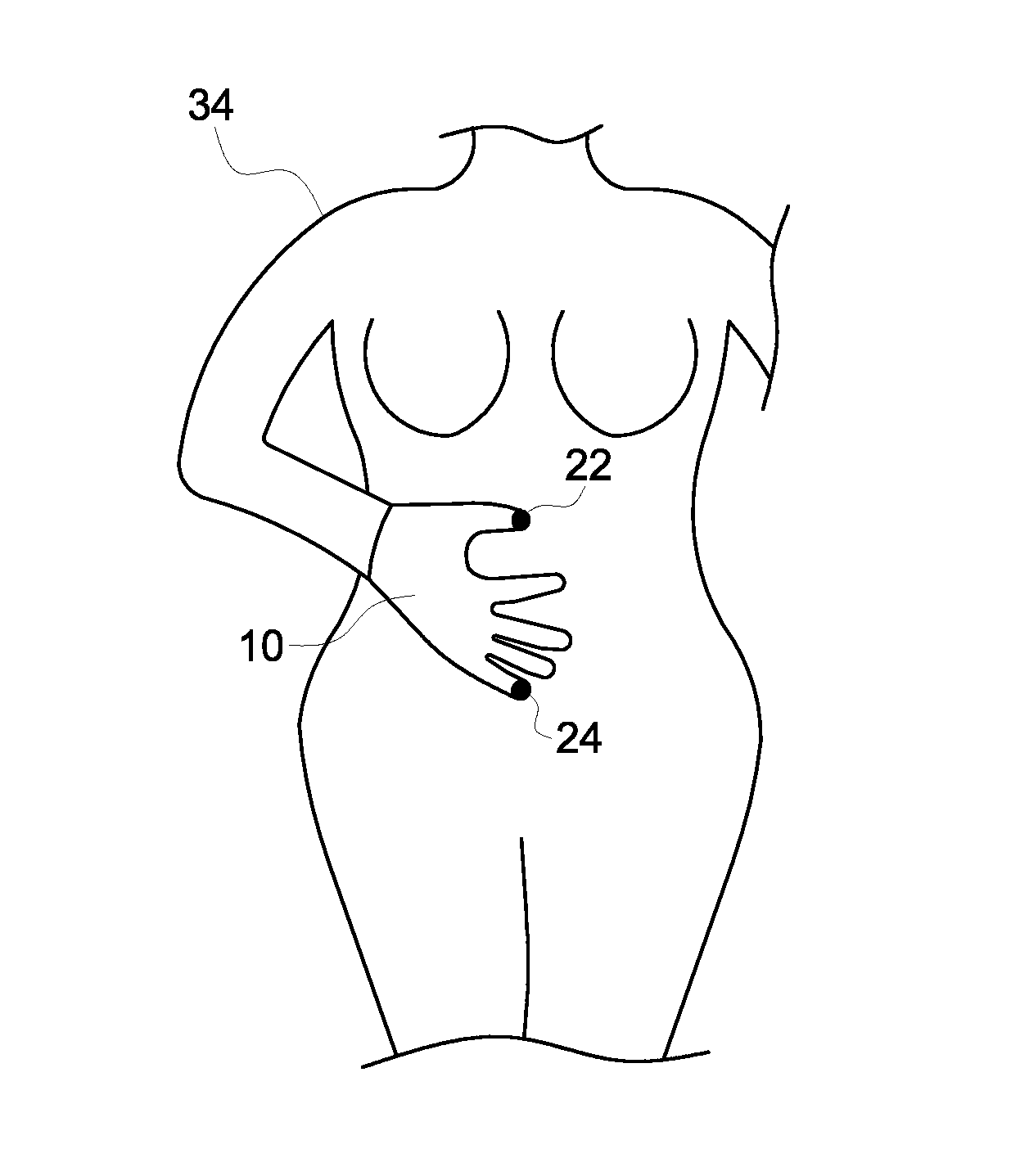 Fetal Monitoring Device and Method