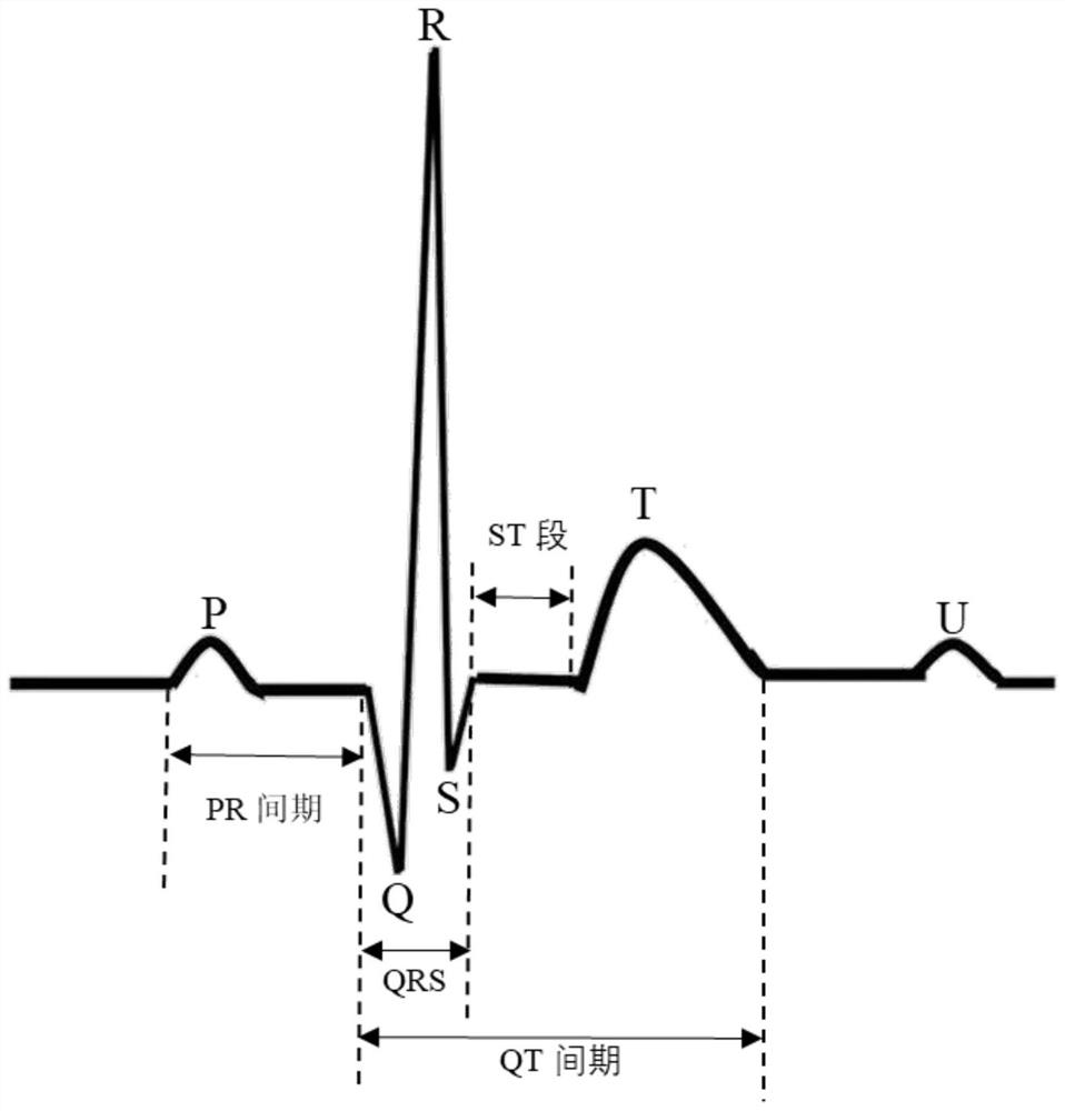 Electrocardiosignal feature point detection method and system