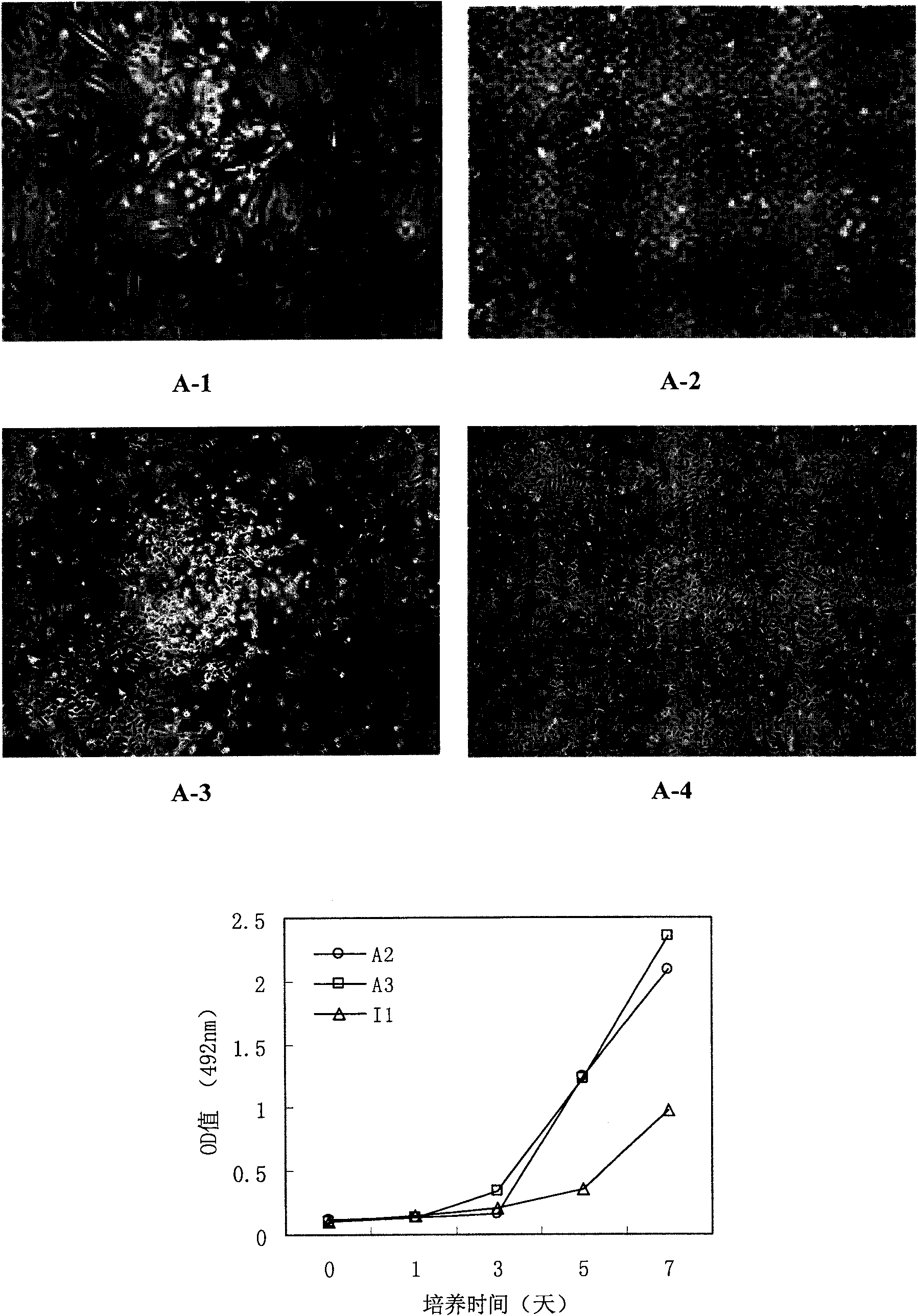 Human tumor stem cell line and application thereof