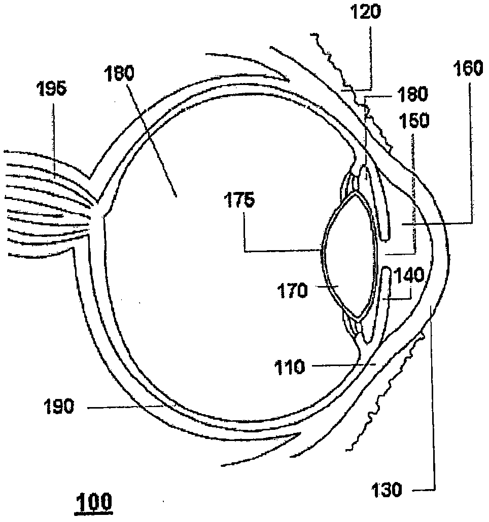 Advanced electro-active optic device