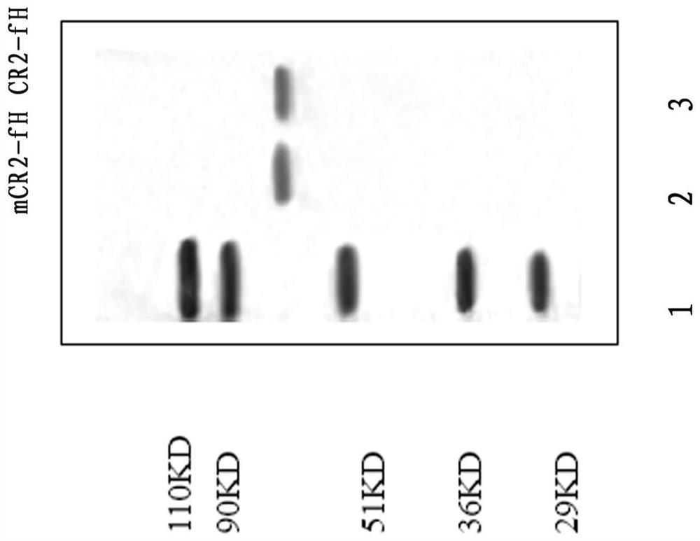 Human target complement inhibitor protein mcr2-fh and its application