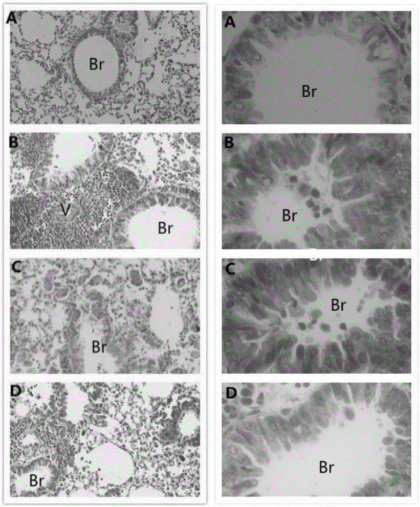 Application of rosmarinic acid to preparing medicines for treating asthma