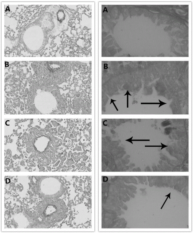 Application of rosmarinic acid to preparing medicines for treating asthma