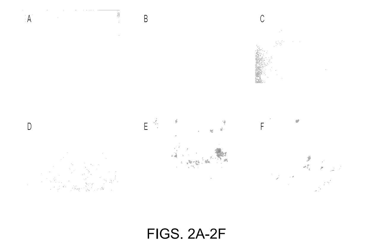 Method for culture of human bladder cell lines and organoids and uses thereof
