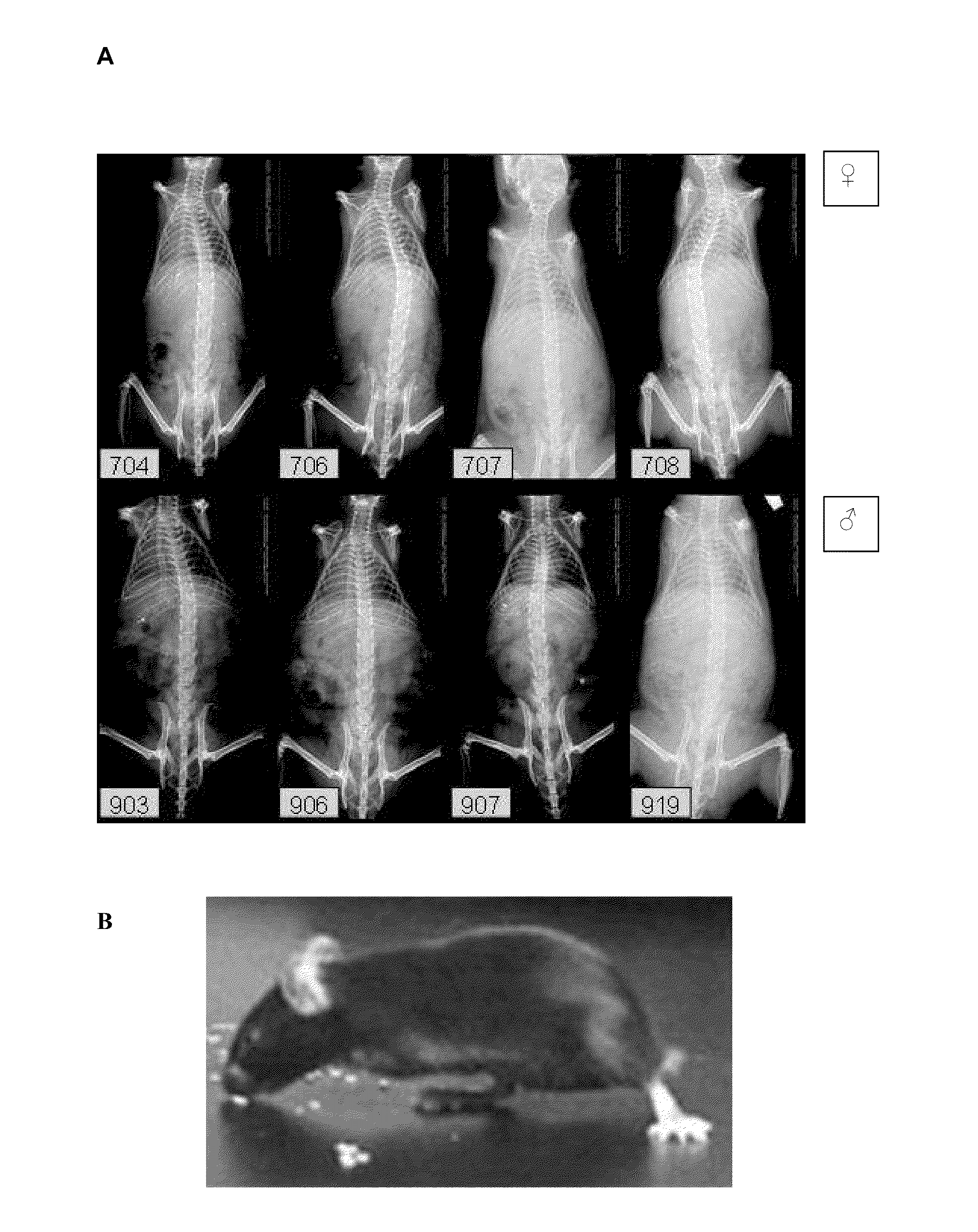 Methods of screening for compounds for use as modulators of left-right asymmetry in scoliotic subjects and for monitoring efficacy of an orthopaedic device
