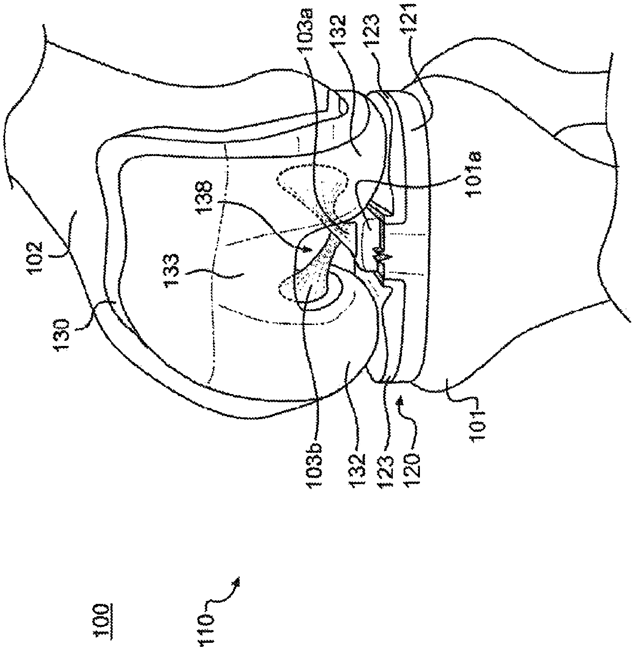 Cruciform Retained Tibial Prosthesis