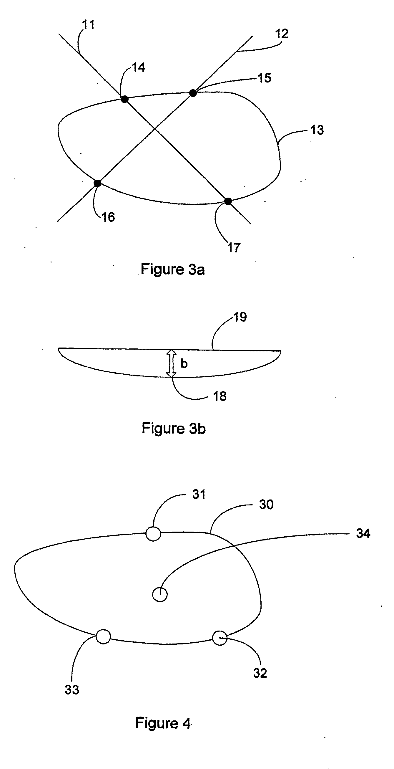 Method of Monitoring a Surface Feature and Apparatus Therefor