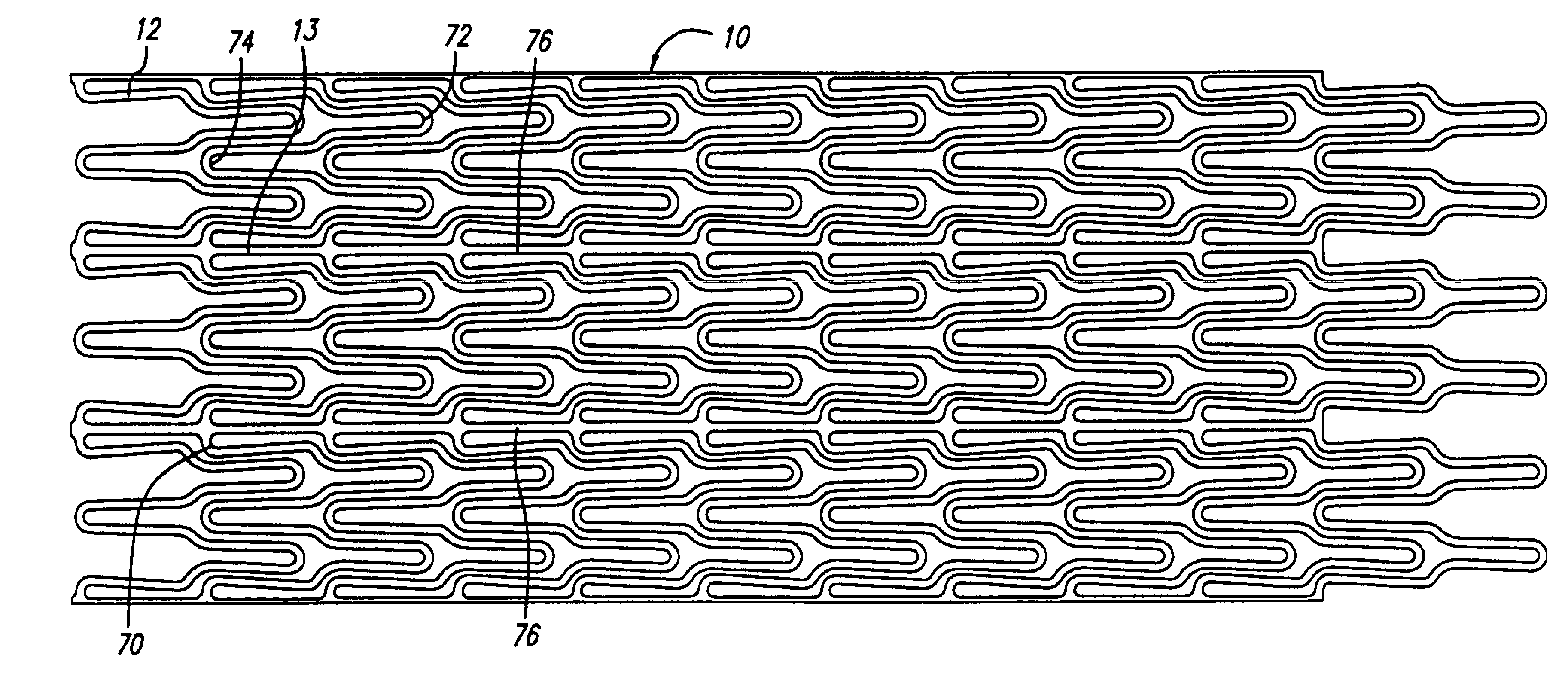 Self-expanding stent with enhanced delivery precision and stent delivery system