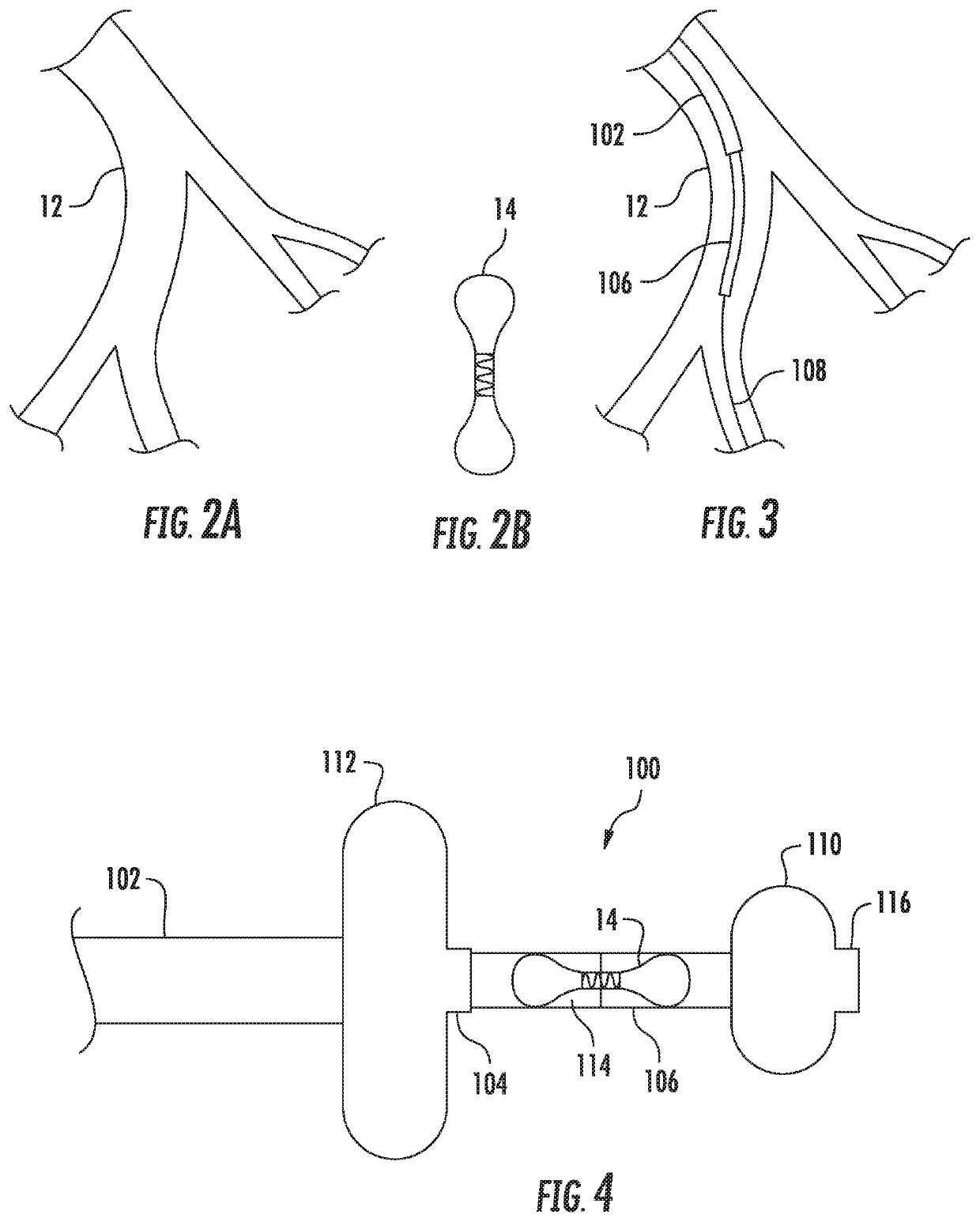 Systems and methods for delivering an implantable device