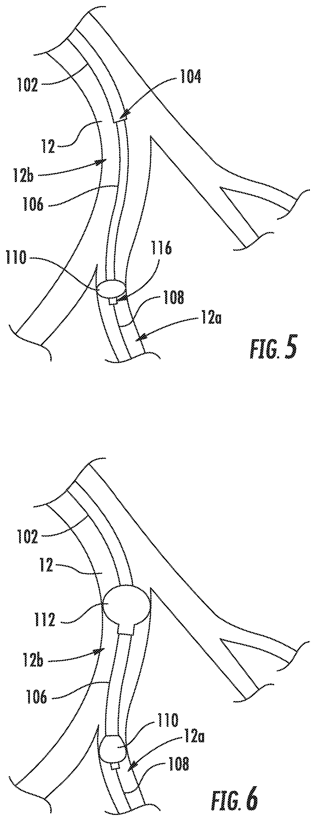 Systems and methods for delivering an implantable device
