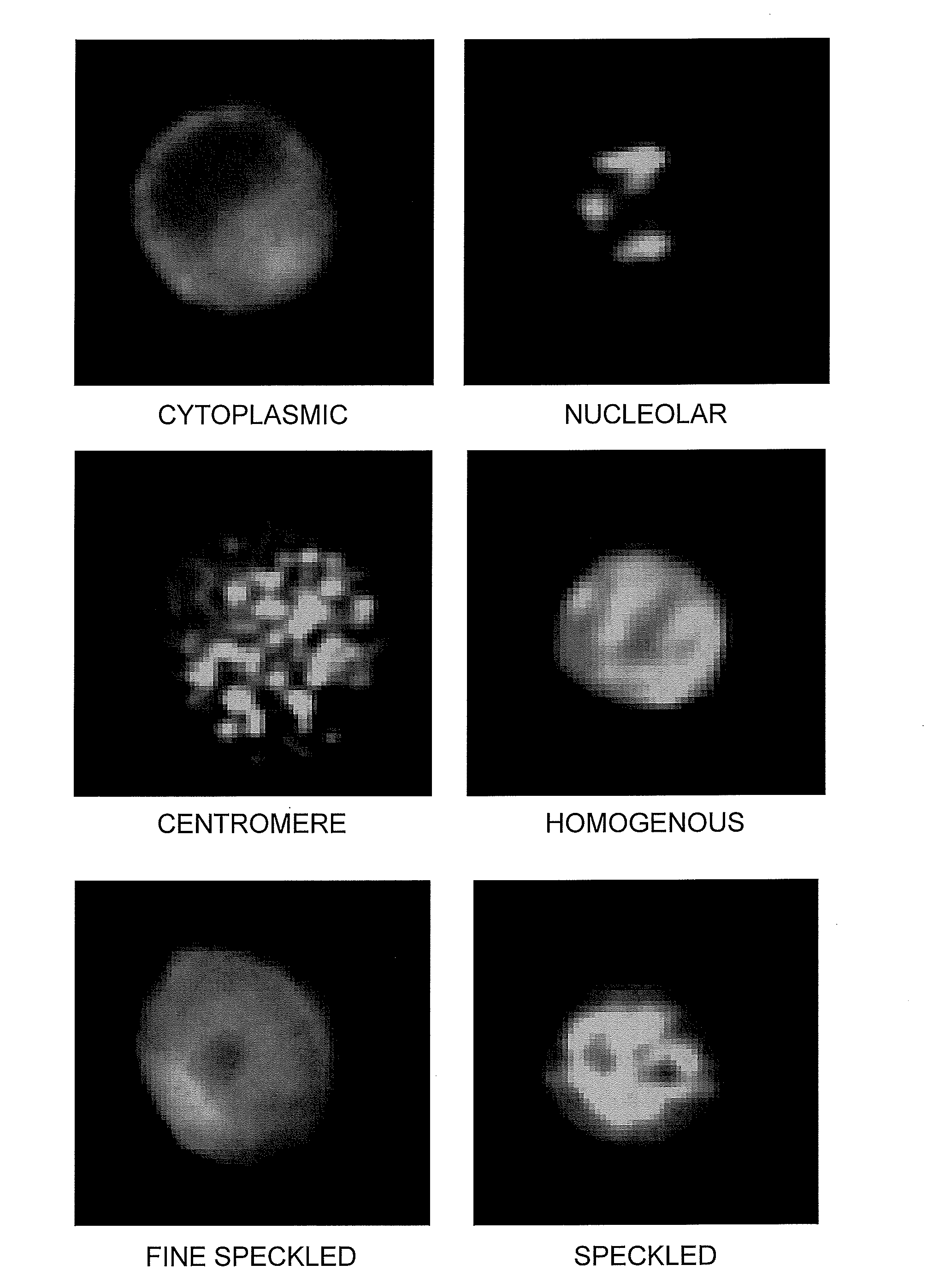 Method for Automated Autoantibody Detection and Identification