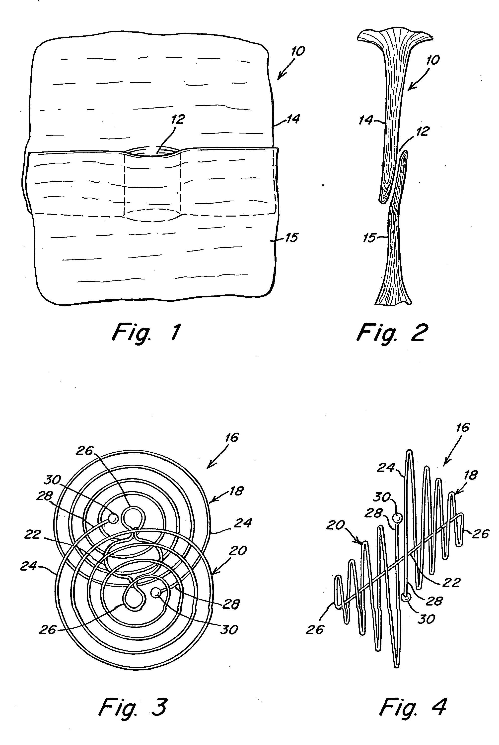 Double spiral patent foramen ovale closure clamp