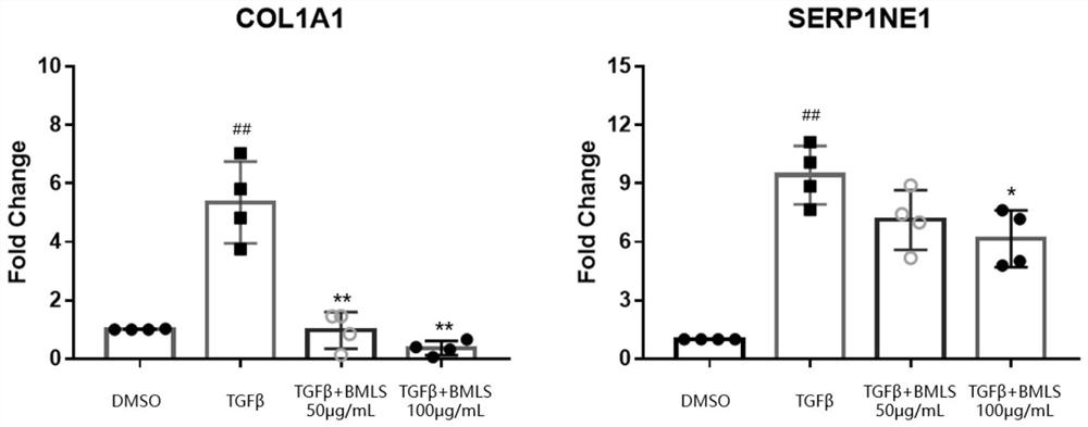 Drug against renal fibrosis and preparation method thereof