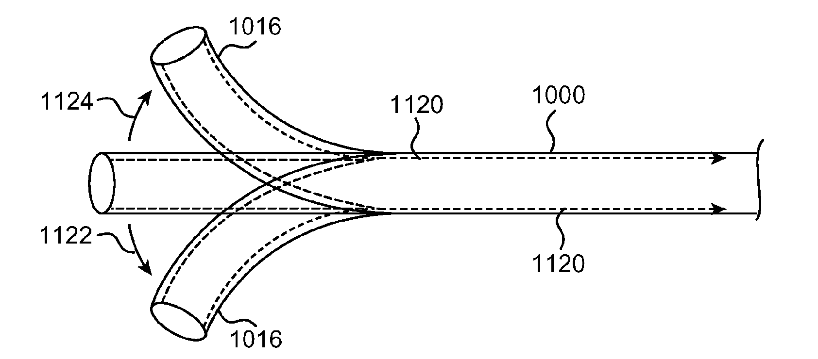 Catheter guiding system and methods