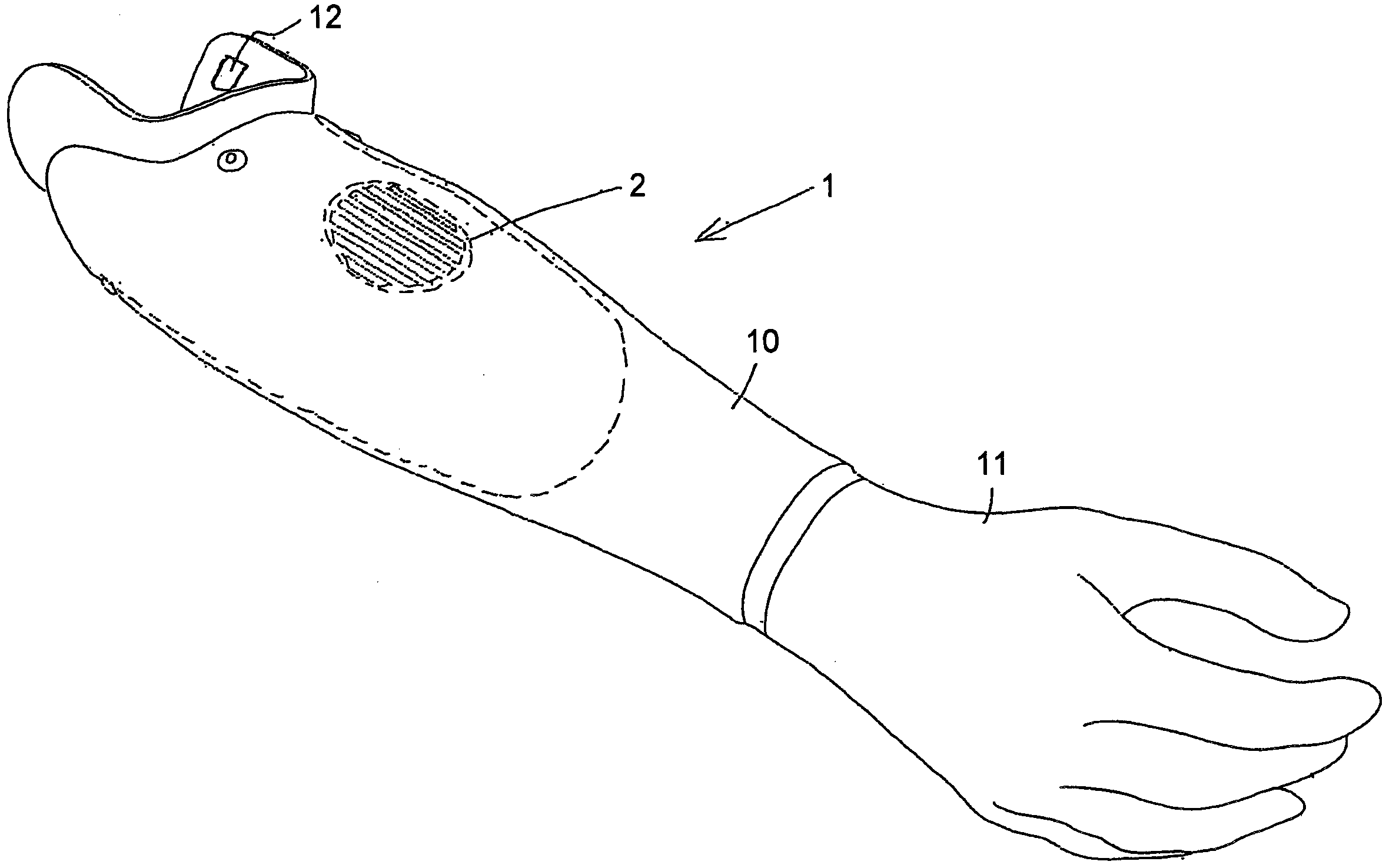 Method for setting up a control and technical orthopedic device
