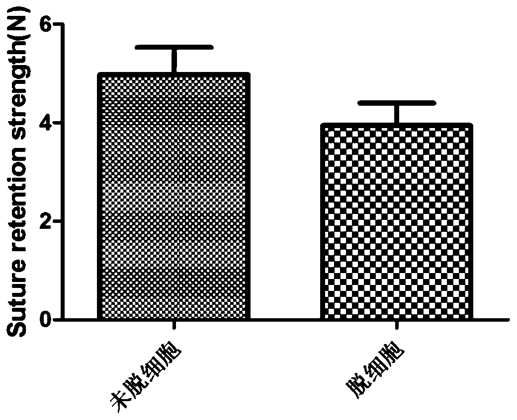 A kind of artificial blood vessel and preparation method thereof