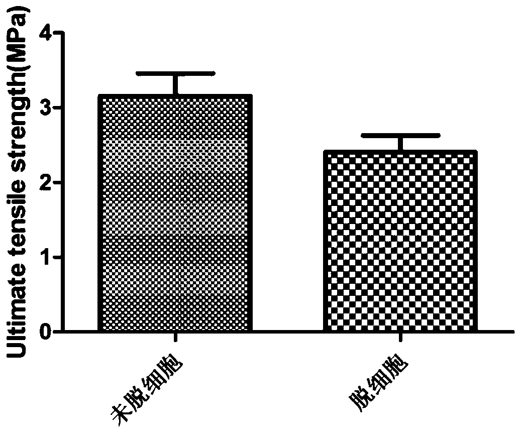 A kind of artificial blood vessel and preparation method thereof