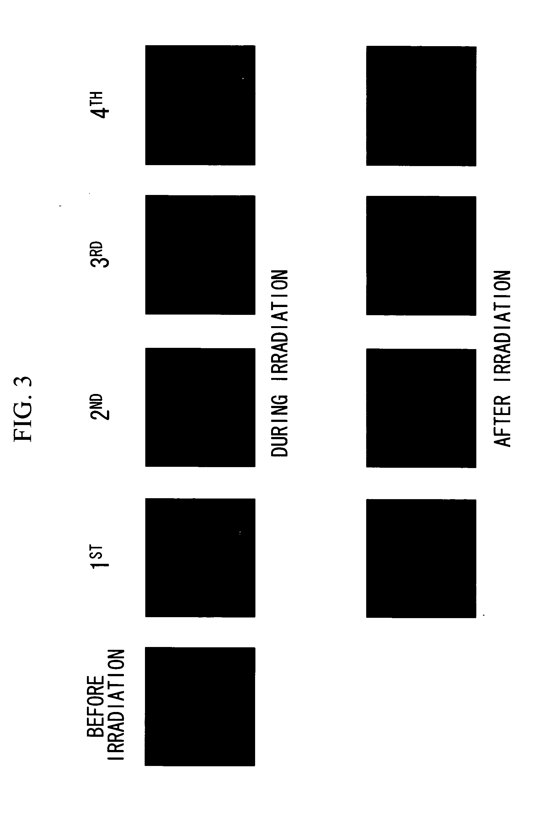 Drug carrier and ultrasound apparatus
