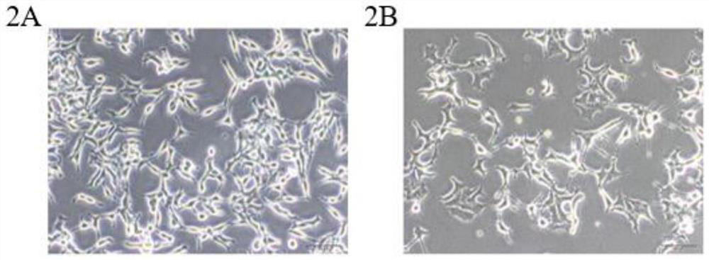 Antisense oligonucleotide of METTL3 and application of antisense oligonucleotide in prostate cancer