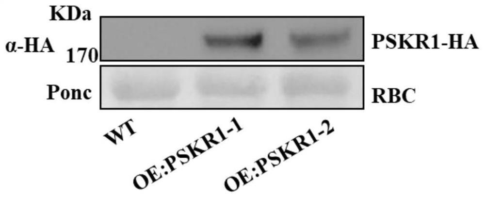 Application of polypeptide receptor PSKR1 gene in improving high-temperature adversity resistance of tomato plant and/or tomato pollen