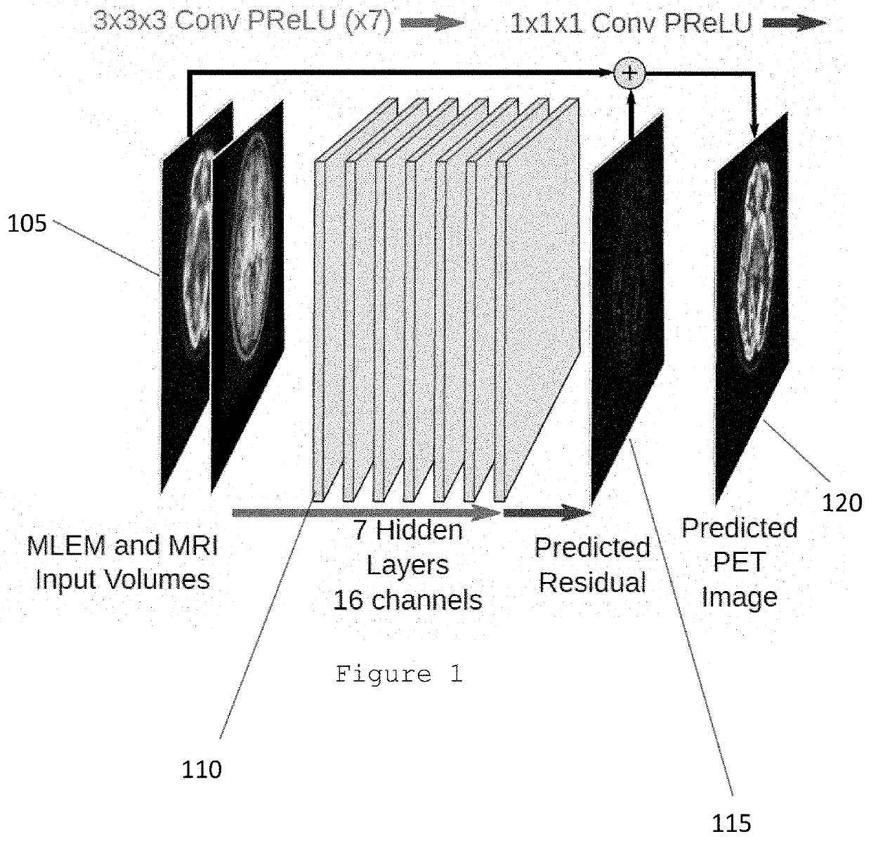 System, method, and computer-accessible medium for generating magnetic resonance imaging-based anatomically guided positron emission tomography reconstruction images with a convolutional neural network