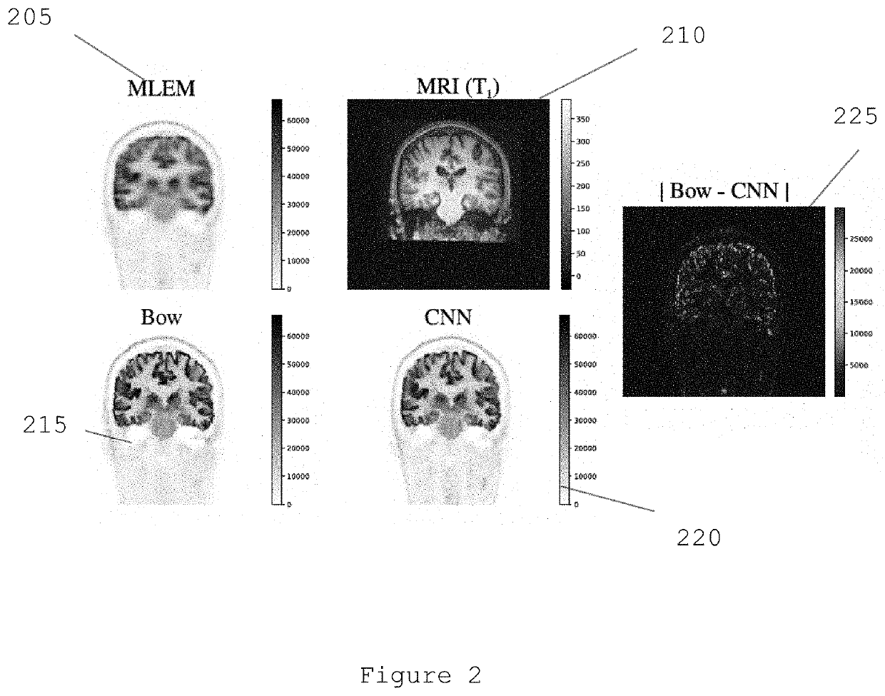 System, method, and computer-accessible medium for generating magnetic resonance imaging-based anatomically guided positron emission tomography reconstruction images with a convolutional neural network