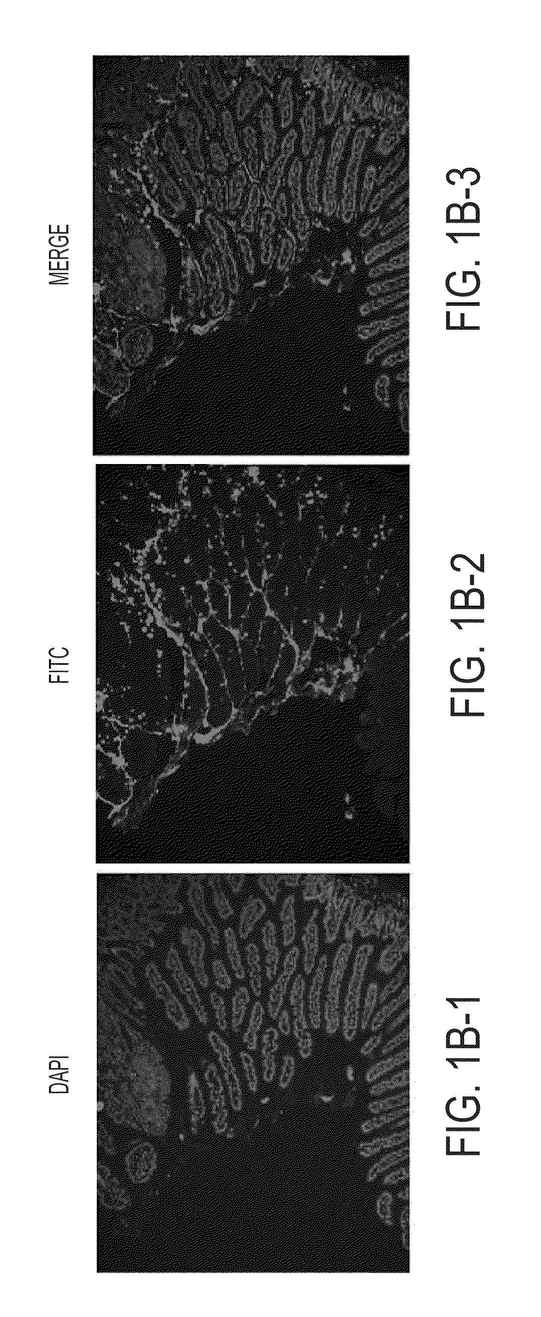 Encapsulated nanoparticles for computed tomography imaging