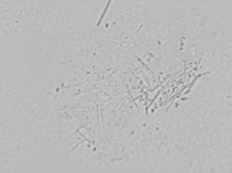 A kind of insulin aspart crystallization process