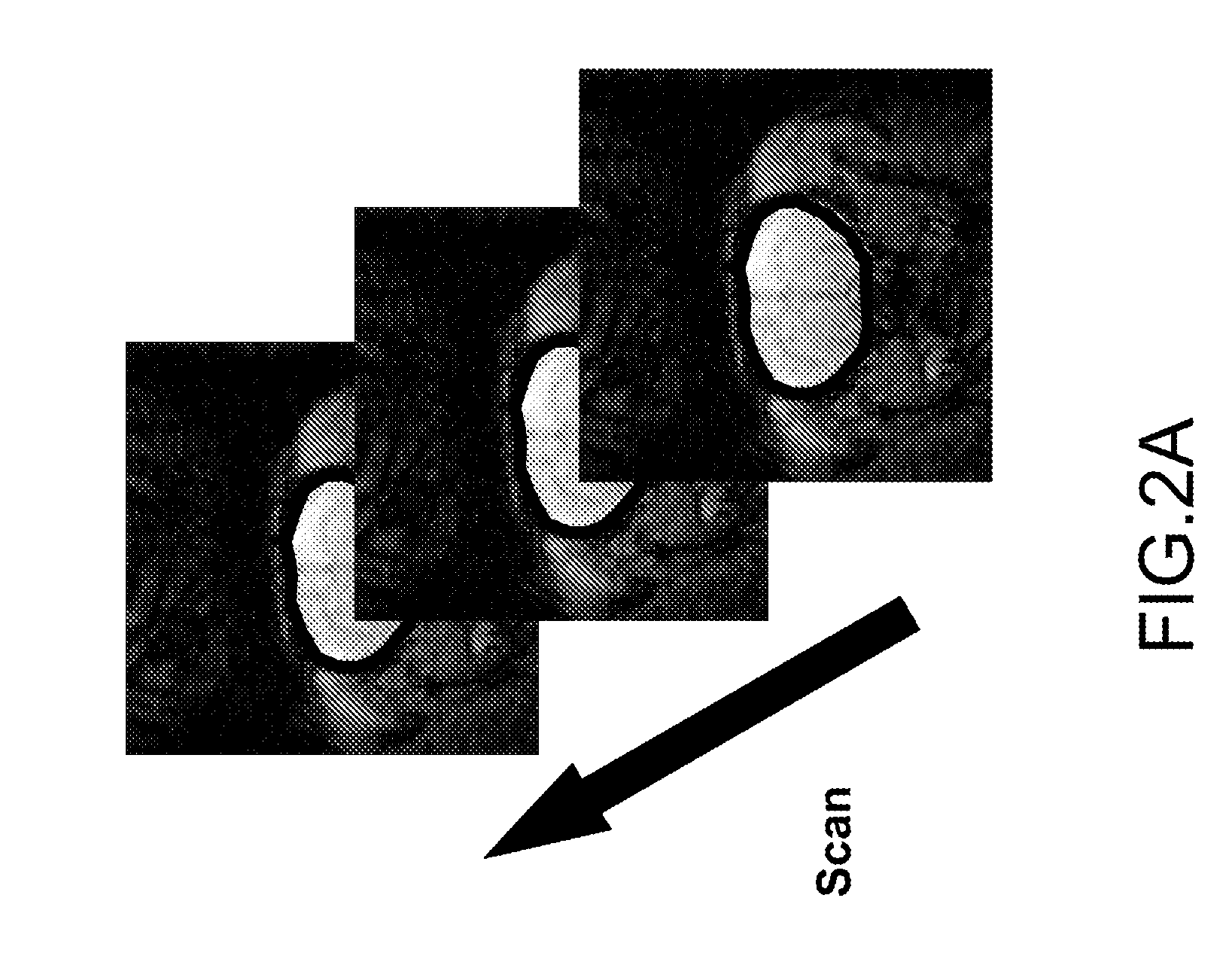 Using Heavy Water as a Contrast Agent for Hydrogen Magnetic Resonance Imaging