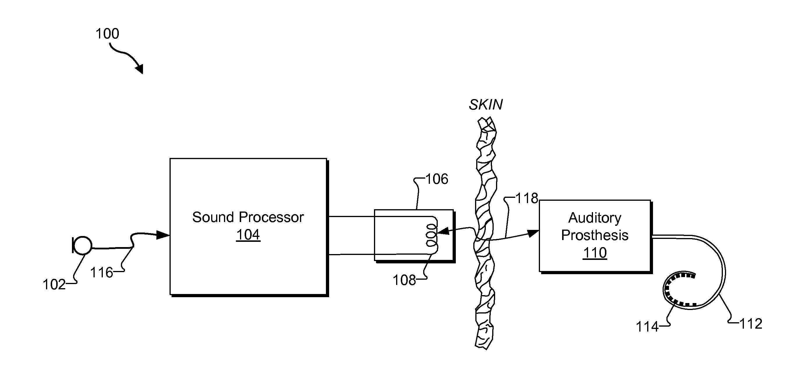 Systems and methods for improving representation by an auditory prosthesis system of audio signals having intermediate sound levels