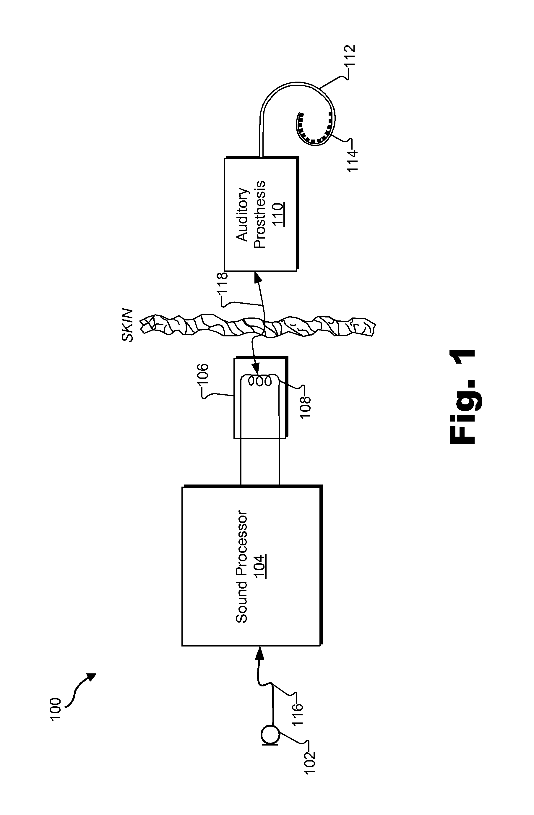 Systems and methods for improving representation by an auditory prosthesis system of audio signals having intermediate sound levels
