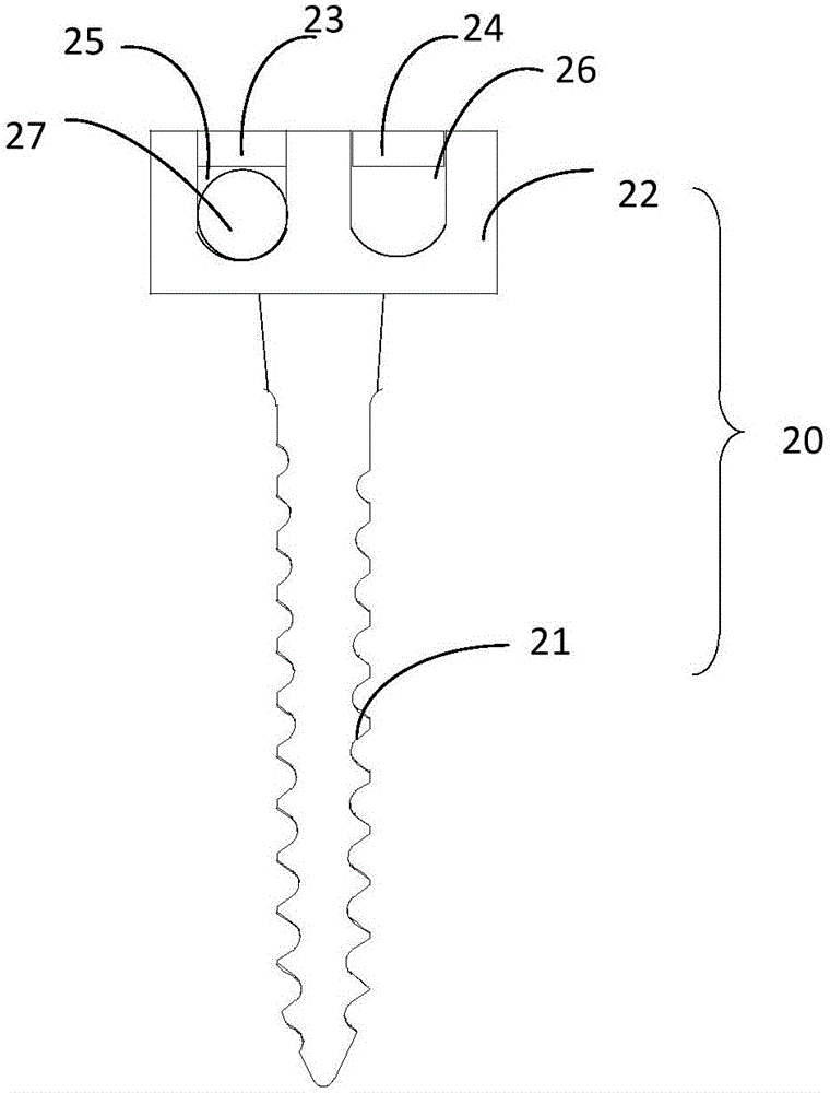 Vertebral pedicle fixator and fixing system