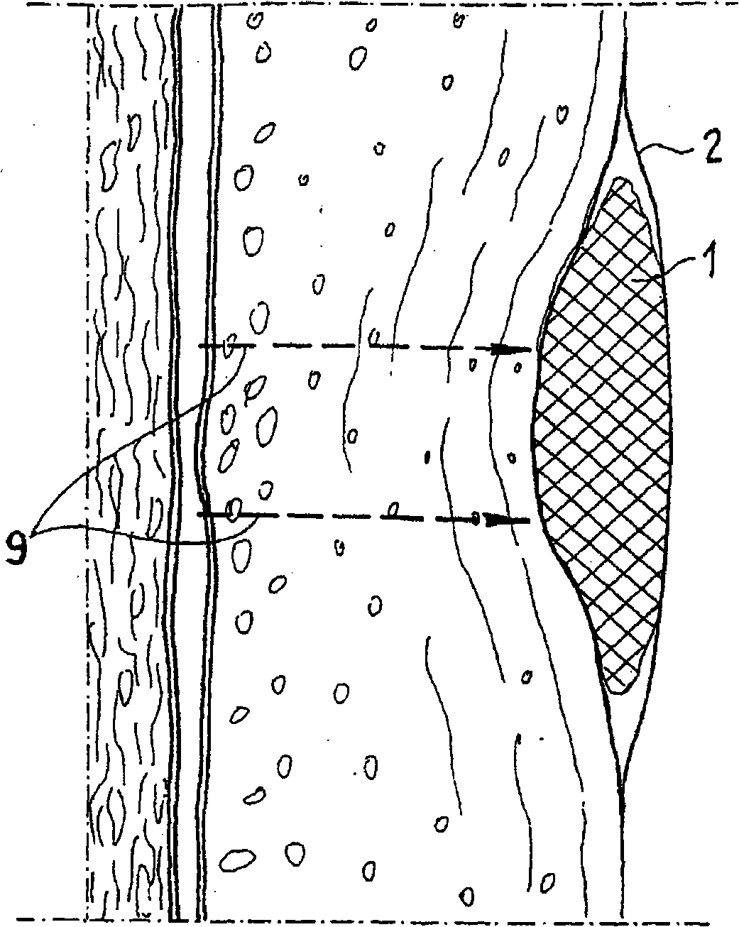 Absorptive element to be mounted on human or animal skin surfaces