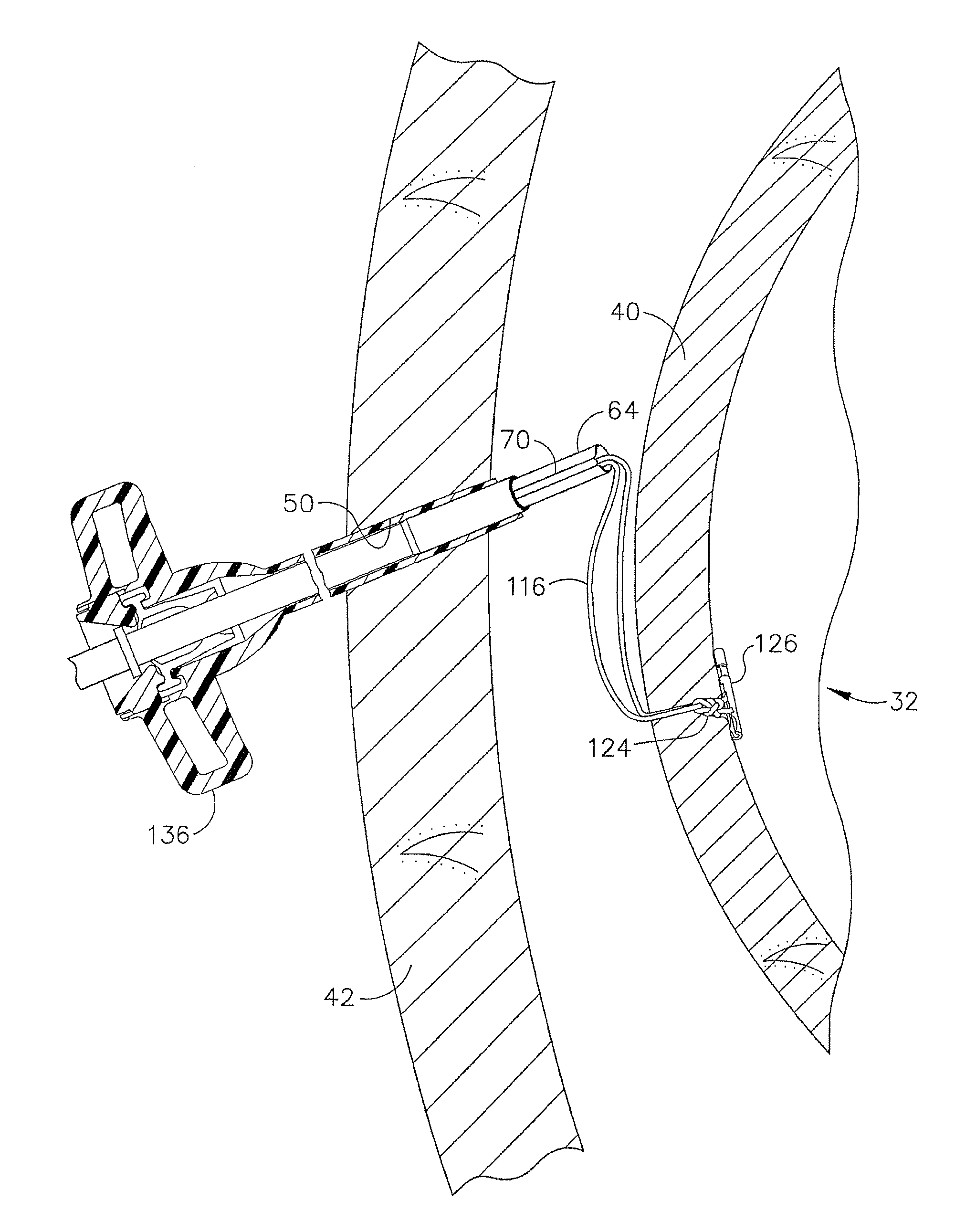 Device for insufflating the interior of a gastric cavity of a patient