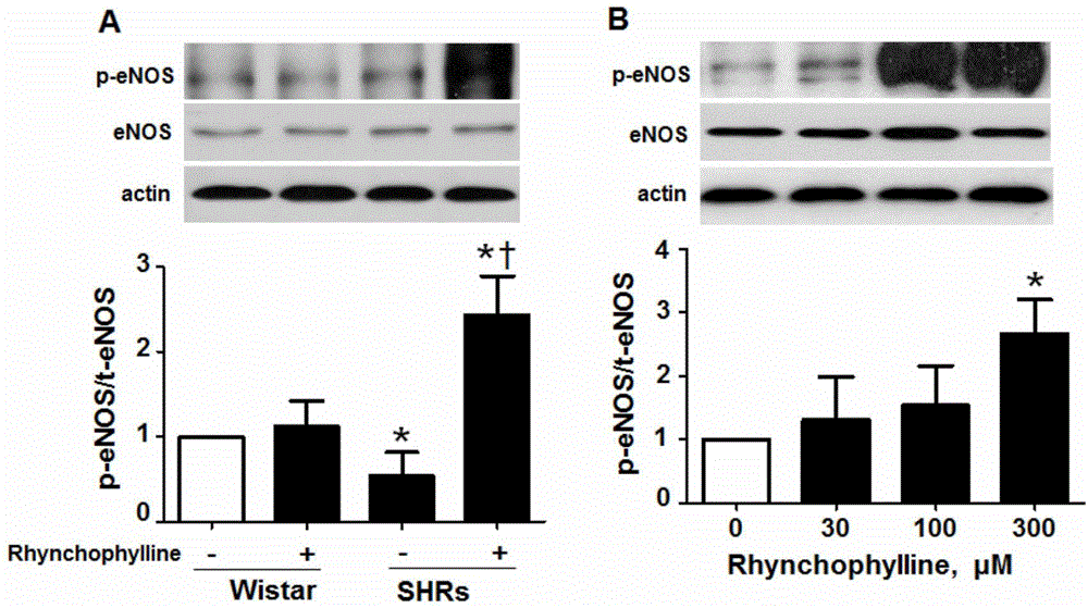 Application of rhynchophylline to preparation of medicines for improving vascular endothelial dysfunction