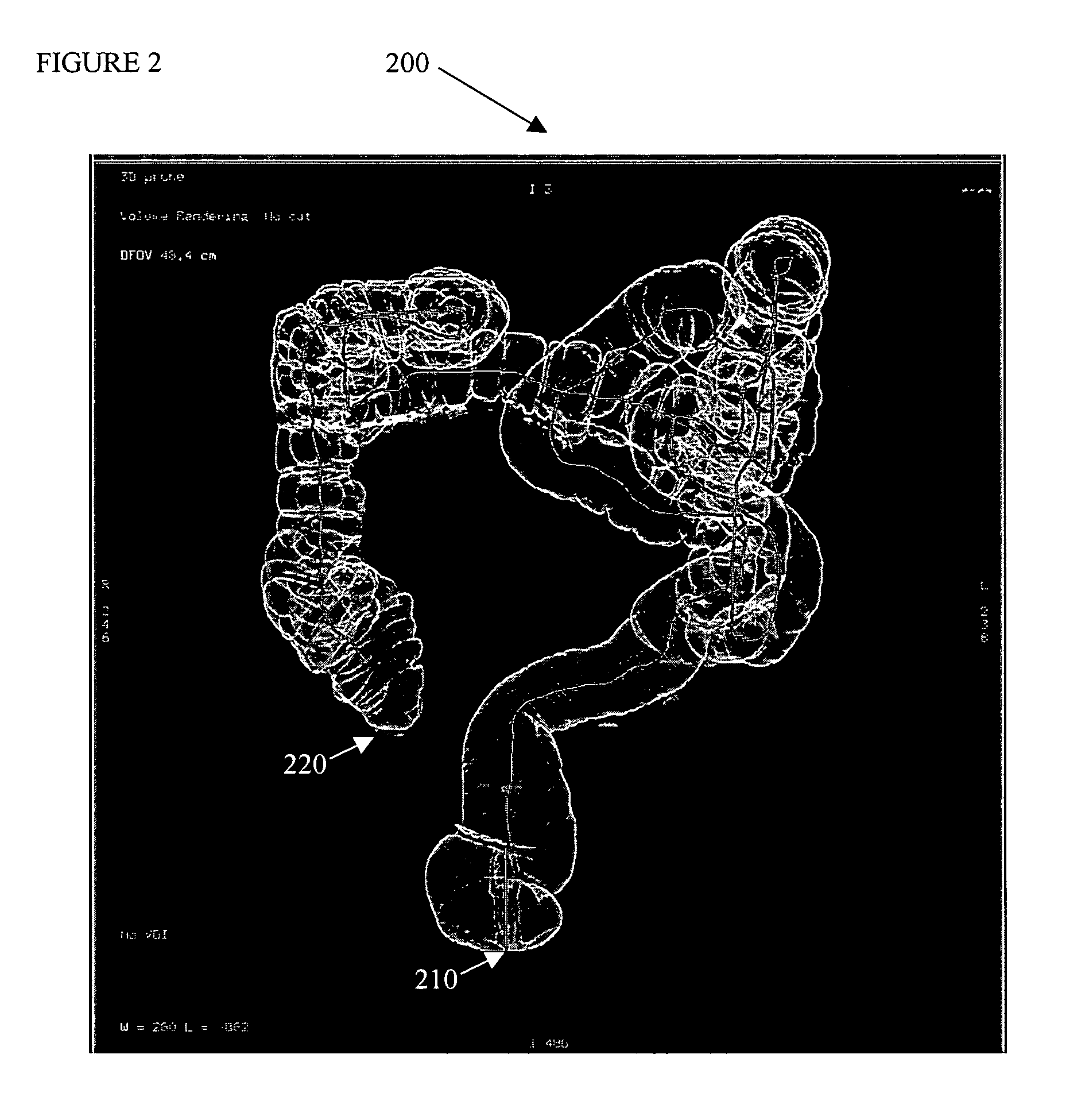System and method for overlaying color cues on a virtual representation of an anatomical structure