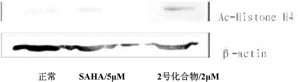 A kind of hydroxamic acid compound and its preparation method and application