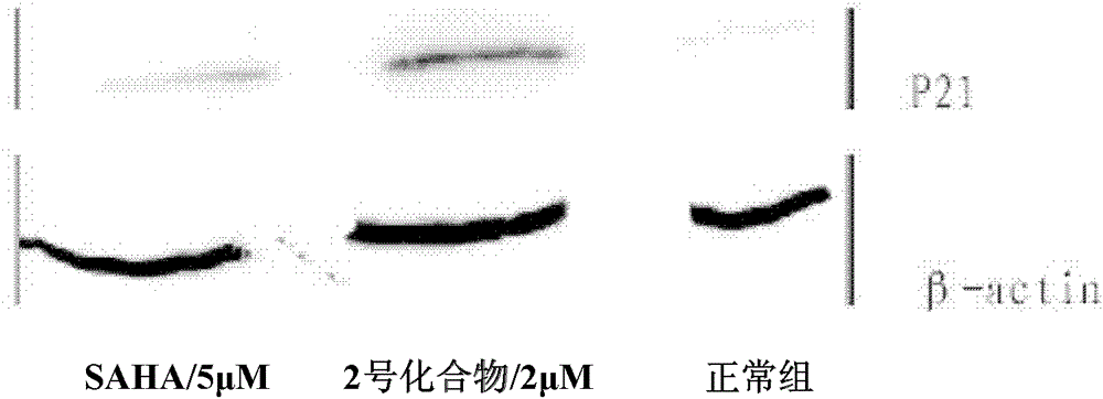 A kind of hydroxamic acid compound and its preparation method and application