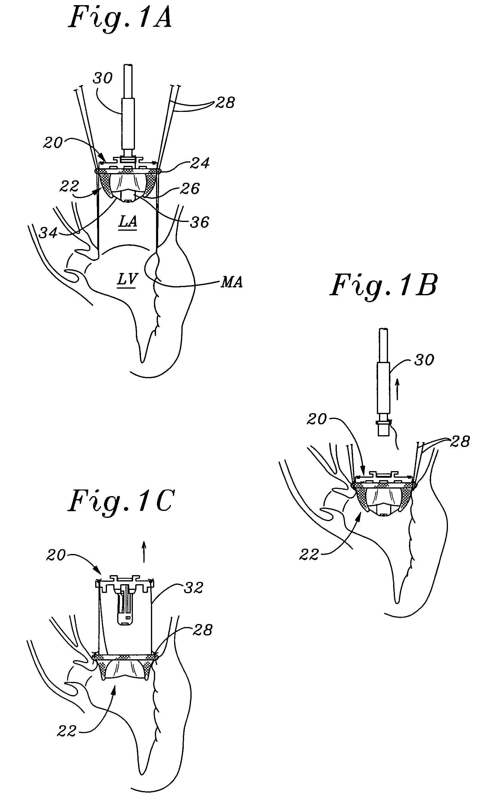 Heart valve holder and method for resisting suture looping