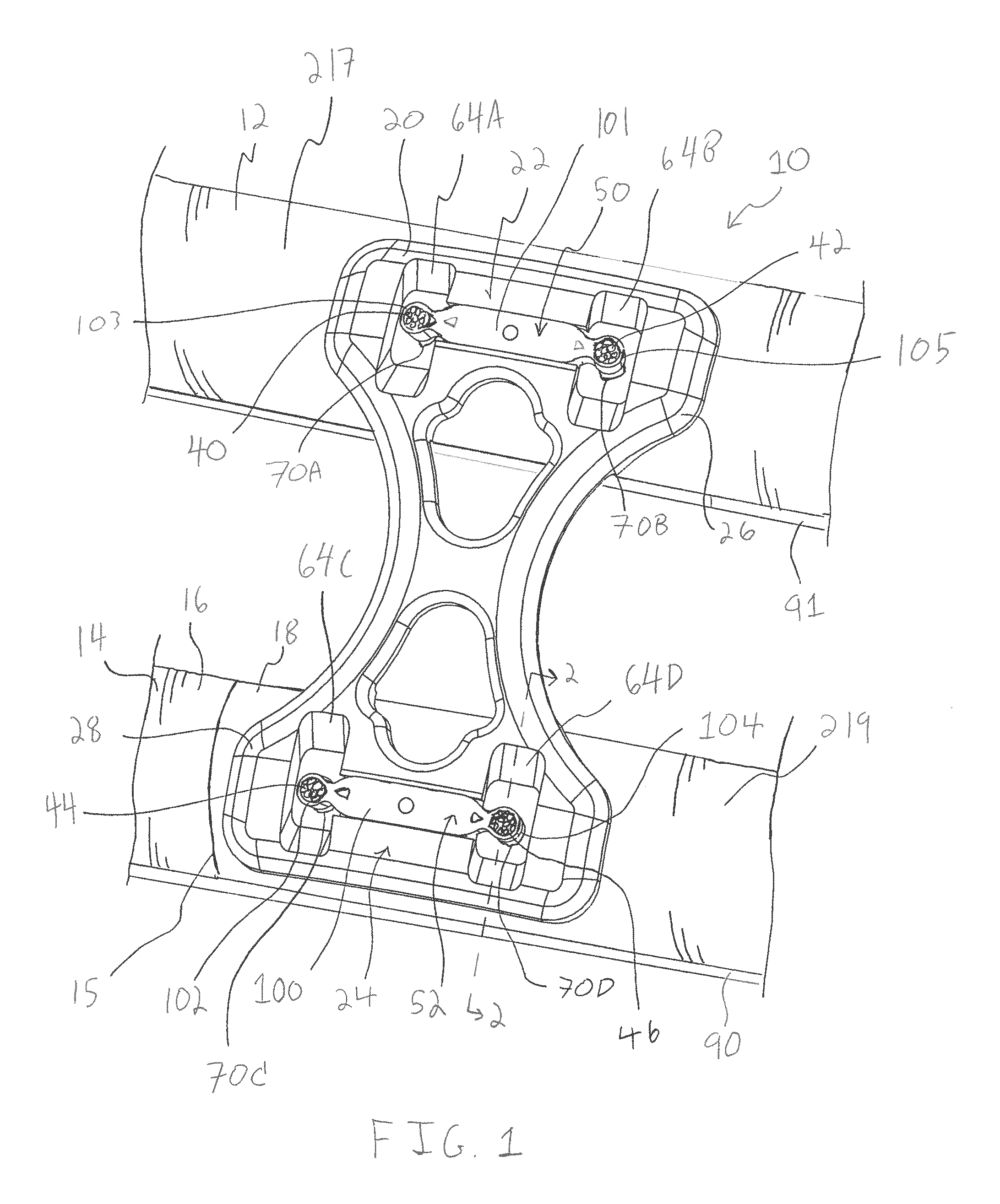 Bone plate system and method