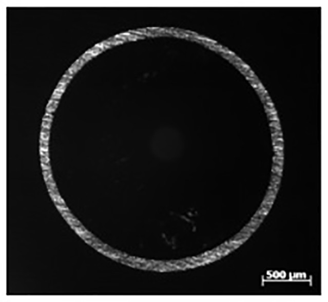 Magnesium-based metal microtubule for medical implantation and preparation method thereof