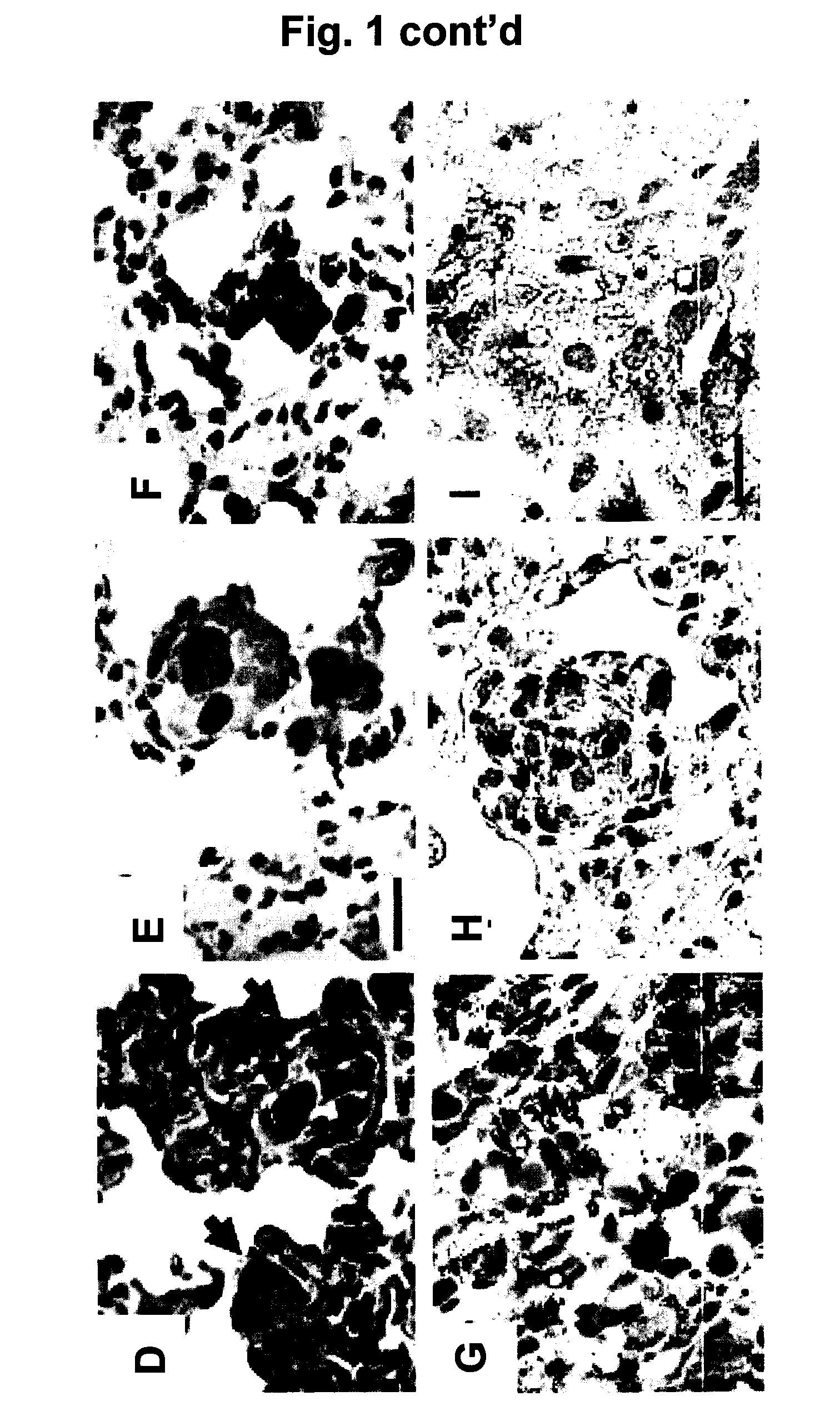 Method for the treatment or prophylaxis of lymphagioleiomymatosis (LAM) and animal model for use in lam research