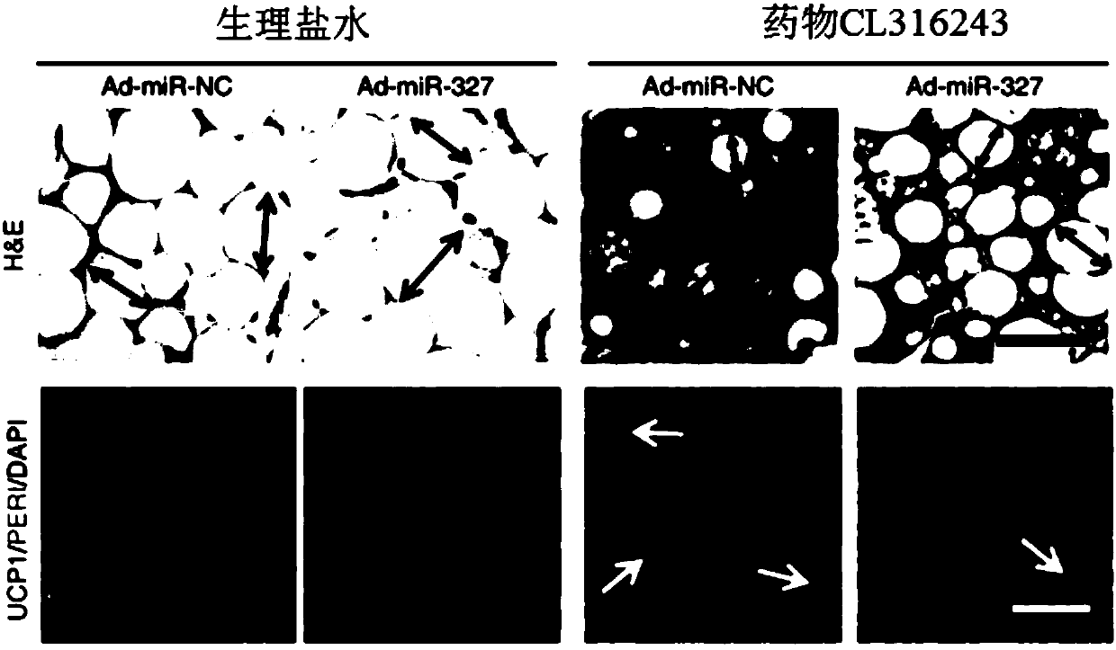 Application of miR-327 inhibitor and/or FGF10 accelerant to medicine for preventing and/or treating diabetes