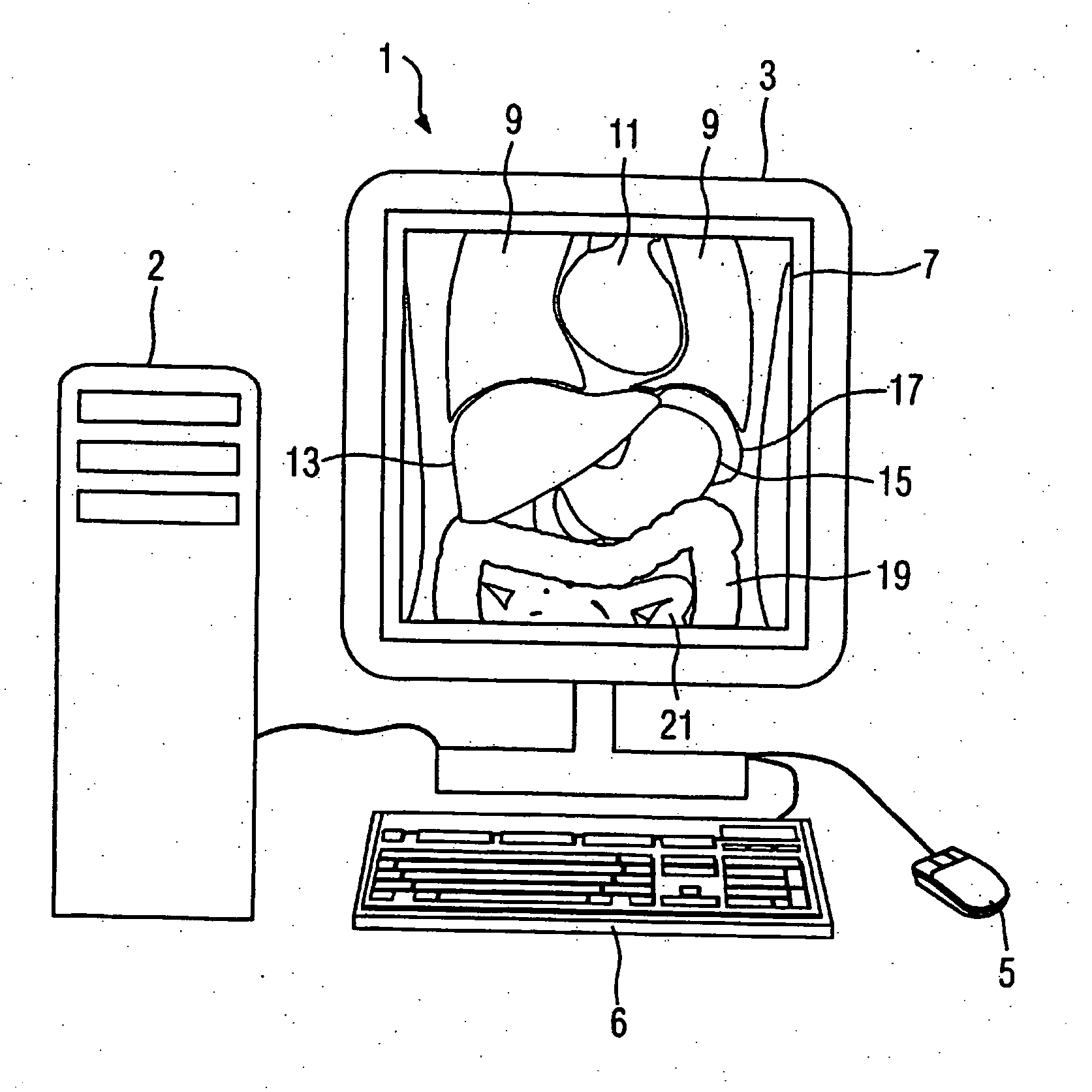 Method and processor for generating a medical image