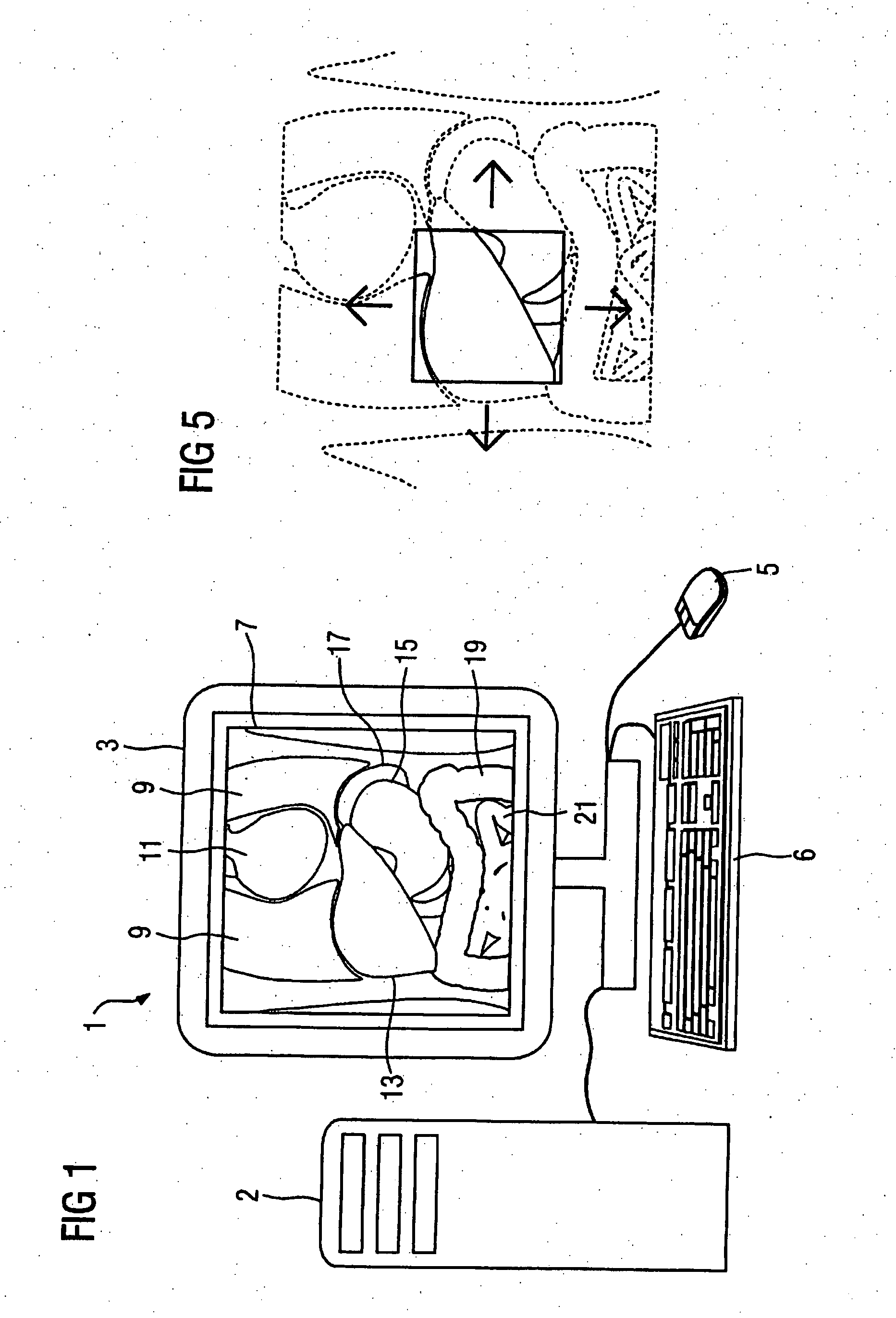 Method and processor for generating a medical image