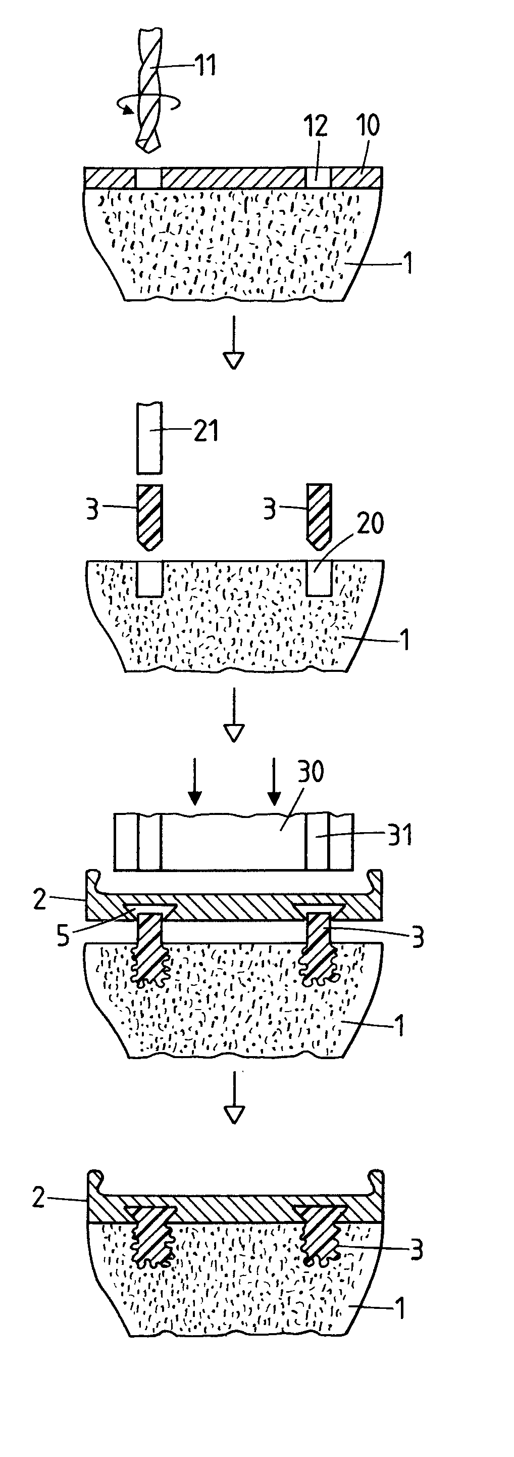Method for fastening an implant to bone tissue and corresponding implant system