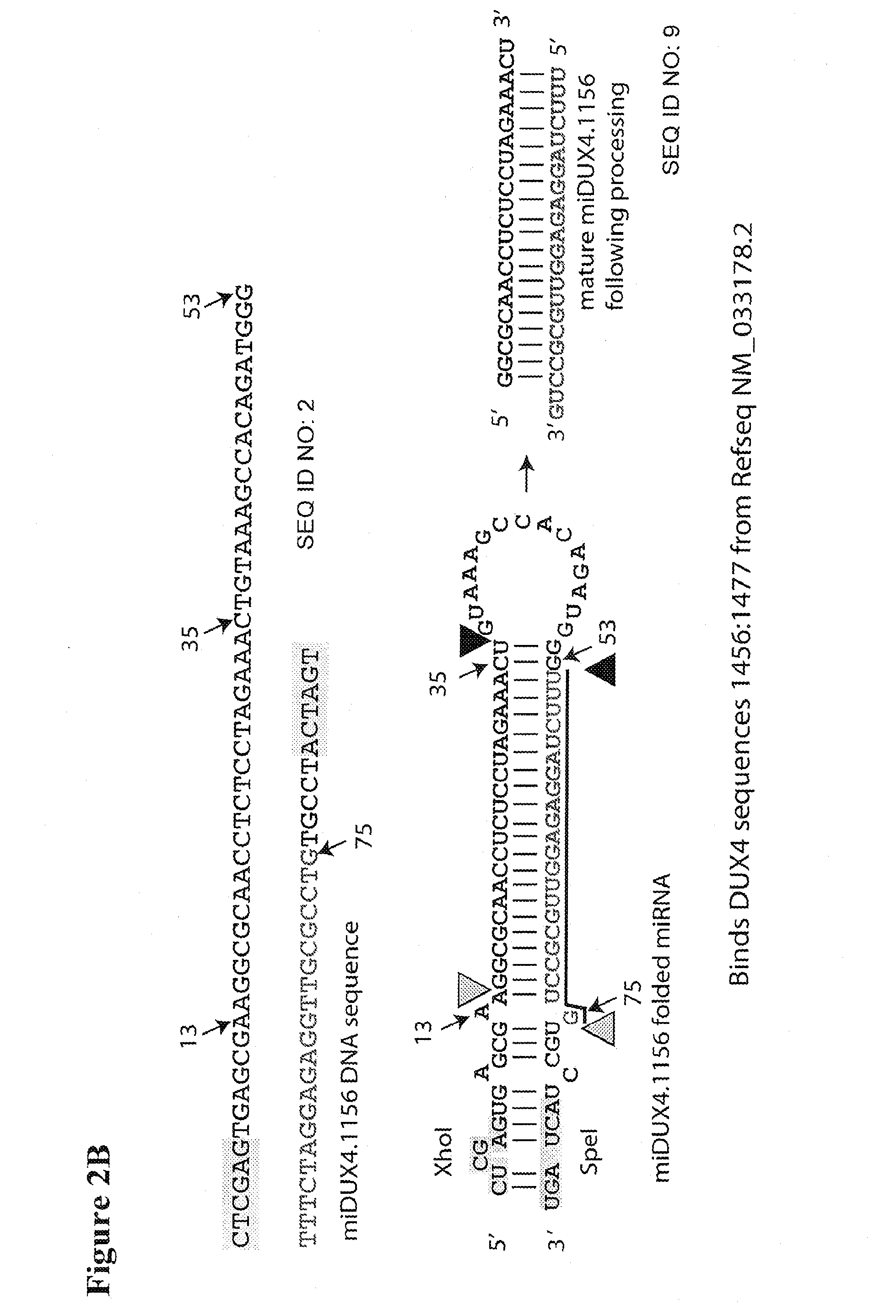 Recombinant Virus Products and Methods for Inhibition of Expression of DUX4