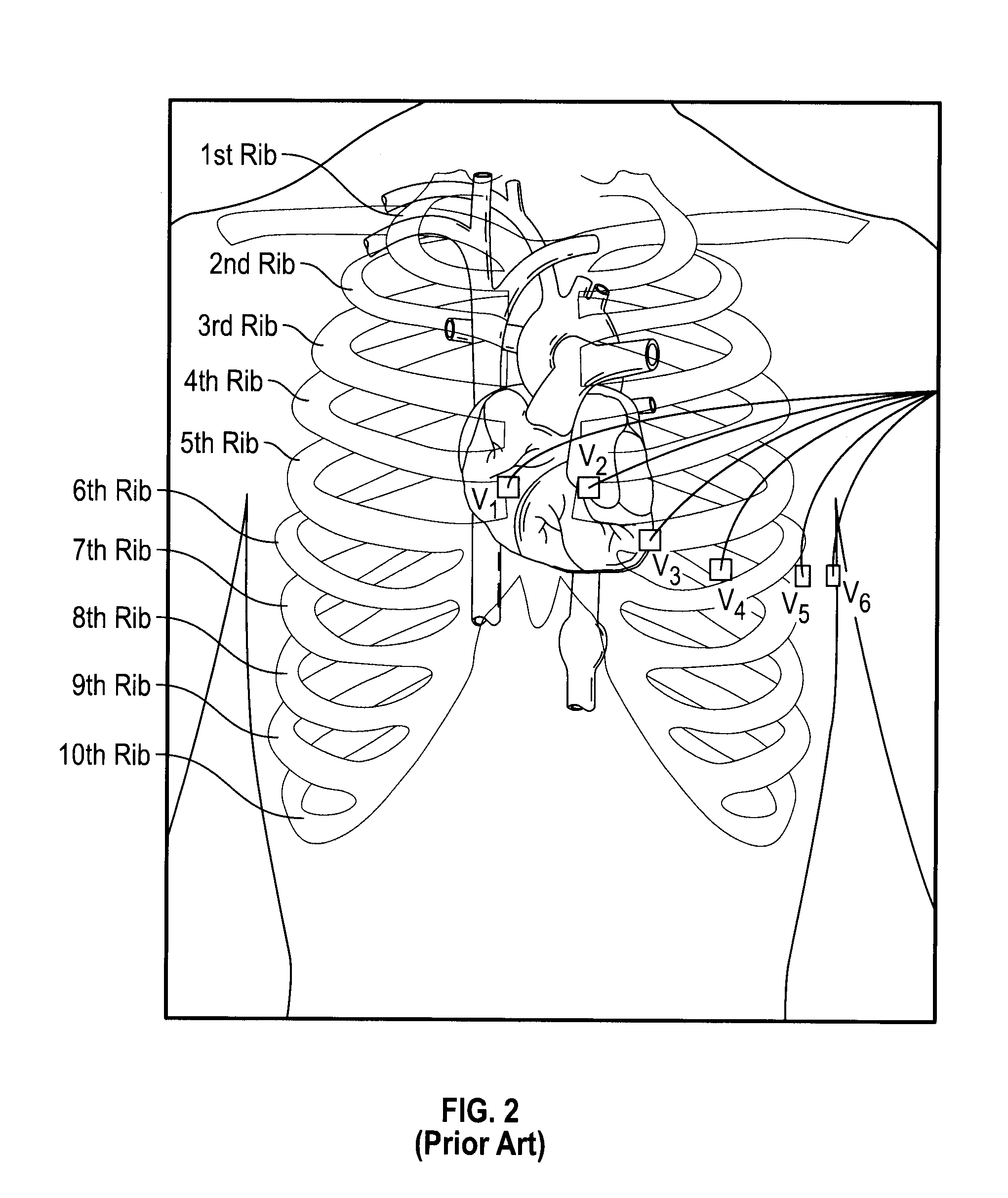 Two Electrode Apparatus and Methods for Twelve Lead ECG